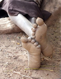 THE FEET OF A WOMAN NAMED POKO